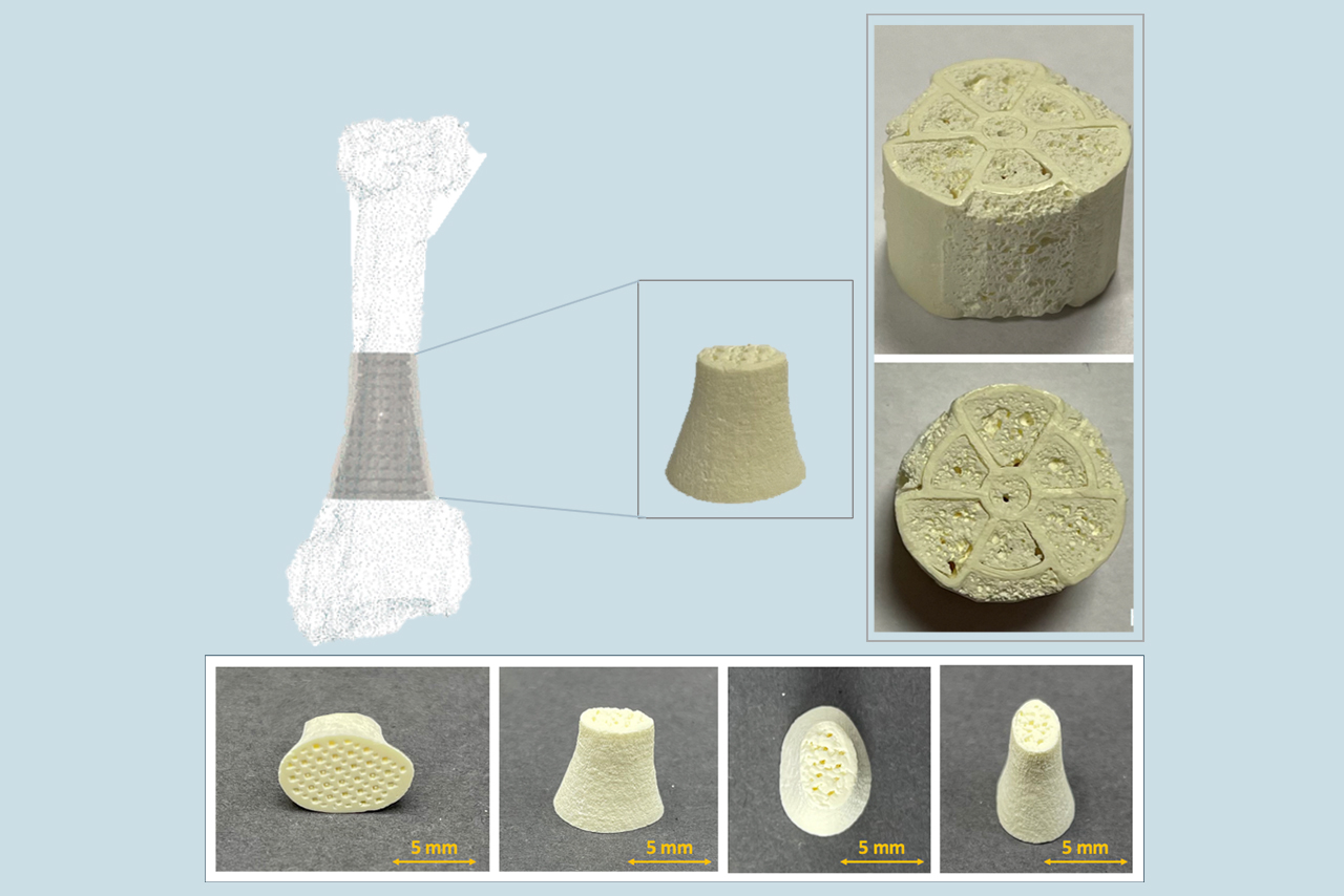 Keramische Knochenimplantate